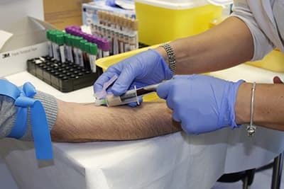 A blood sample being drawn for laboratory allergy testing.